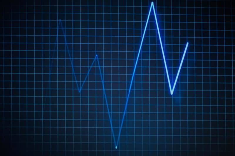 diagram heartbeat of a hibernating hedgehog